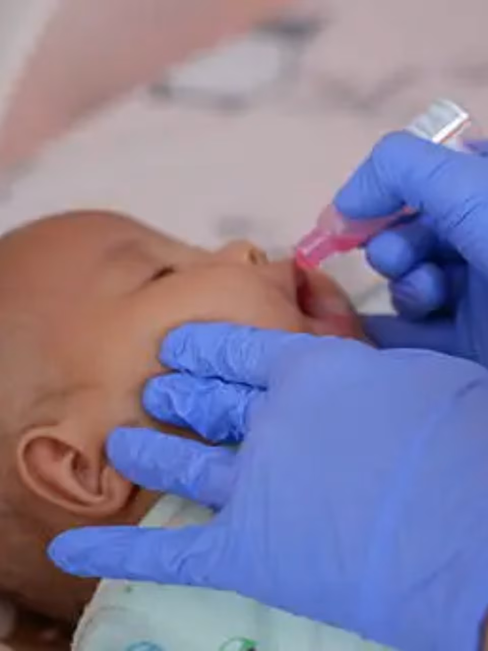 World Polio Day 2025: Eradication and Prevention of Polio – The Indian Express