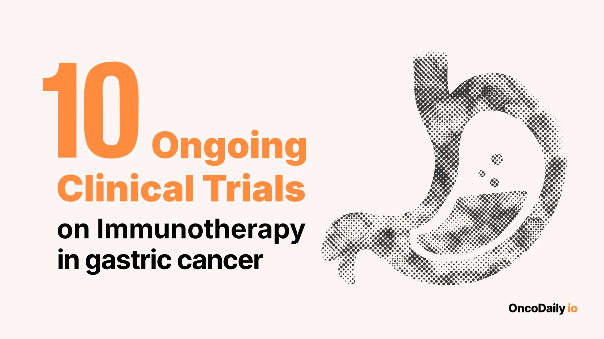 10 ongoing Clinical Trials on Immunotherapy in Breast Cancer 3 10 ongoing Clinical Trials on Immunotherapy in Breast Cancer