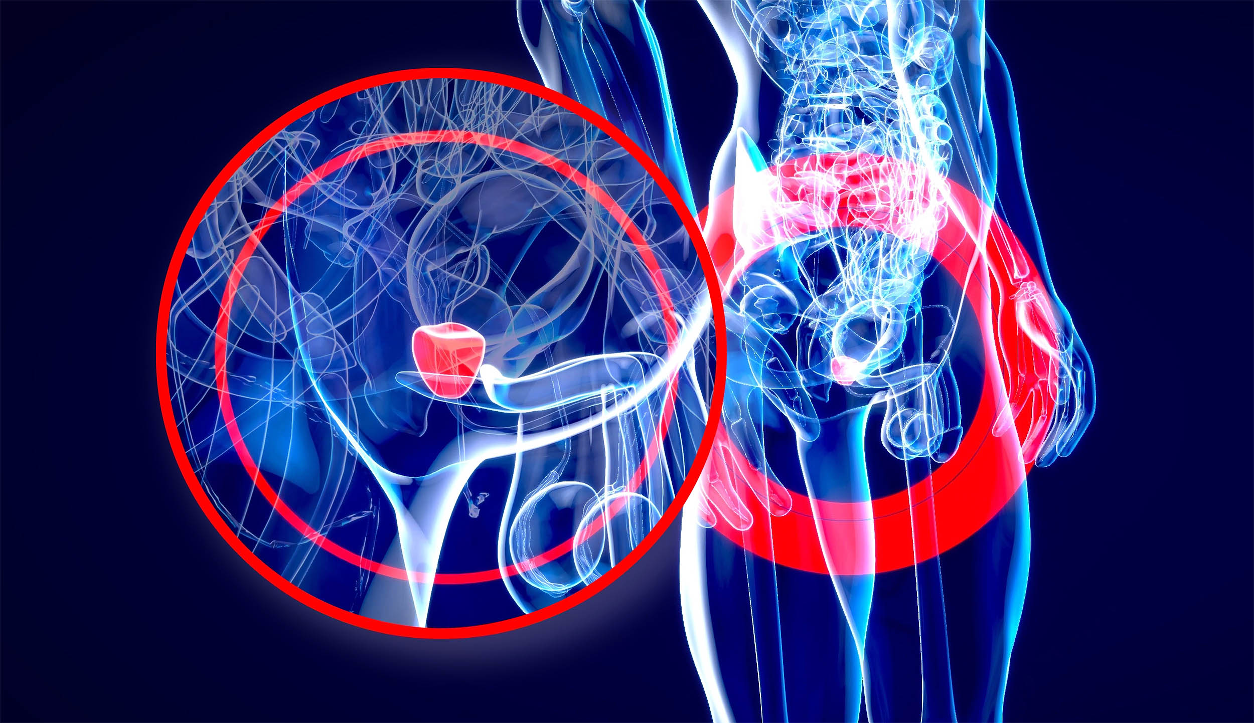 New drug combination slows progression of BRCA prostate cancer