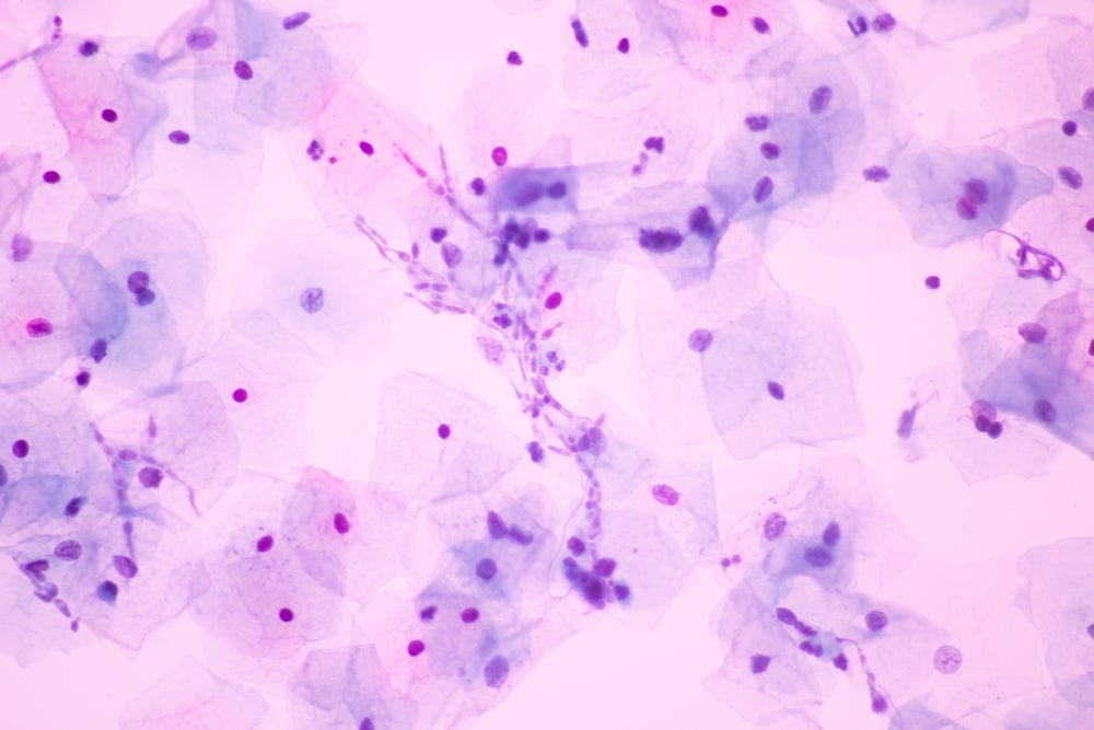 EL219 shows favourable safety and PK profile in Phase I studies