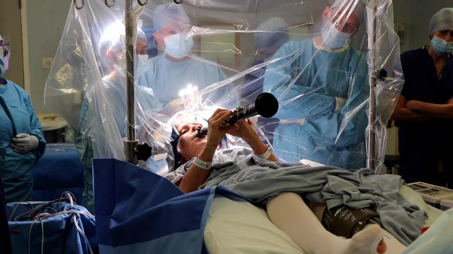 A Parkinson’s patient plays clarinet during Deep Brain Stimulation surgery – The Washington Post