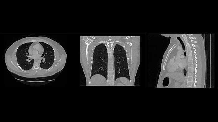 Synthetic medical imaging: safer, smarter AI
