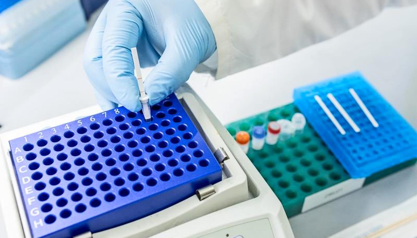 New test could make tuberculosis screening way simpler
