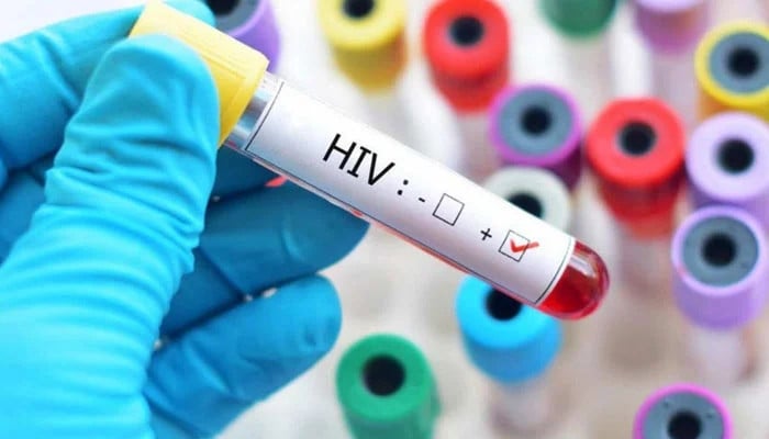 ‘HIV-infected blood’ transfused to child, adult patients