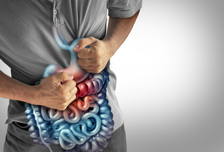 Vedolizumab for Early vs Late Crohn’s Disease