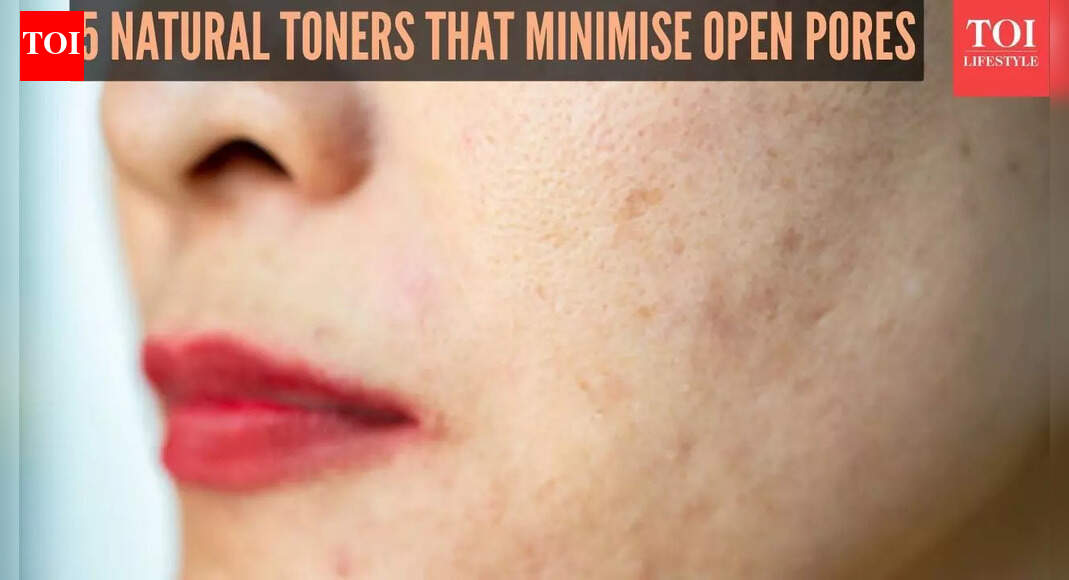 5 natural toners for minimising open pores