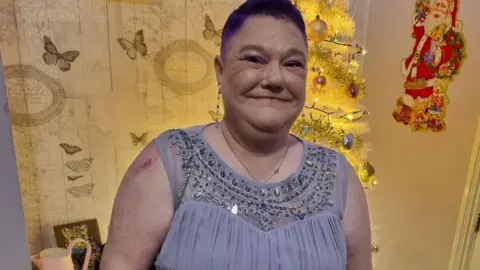 Mencap Annabell Downey has short cropped red hair and a long earing on her right lobe. She is wearing a light blue/grey dress with sequins around the neckline. 