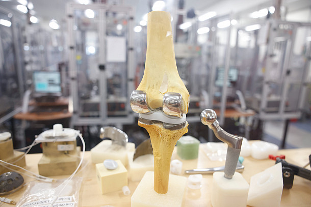 A diagram of a knee with an implant.