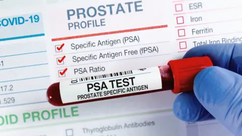 Getty Images A generic shot of a close-up gloved hand holding a test tube with blood in it saying 'PSA Test' and Prostate Specific Antigen. There is a white data card behind with ticks against certain tests