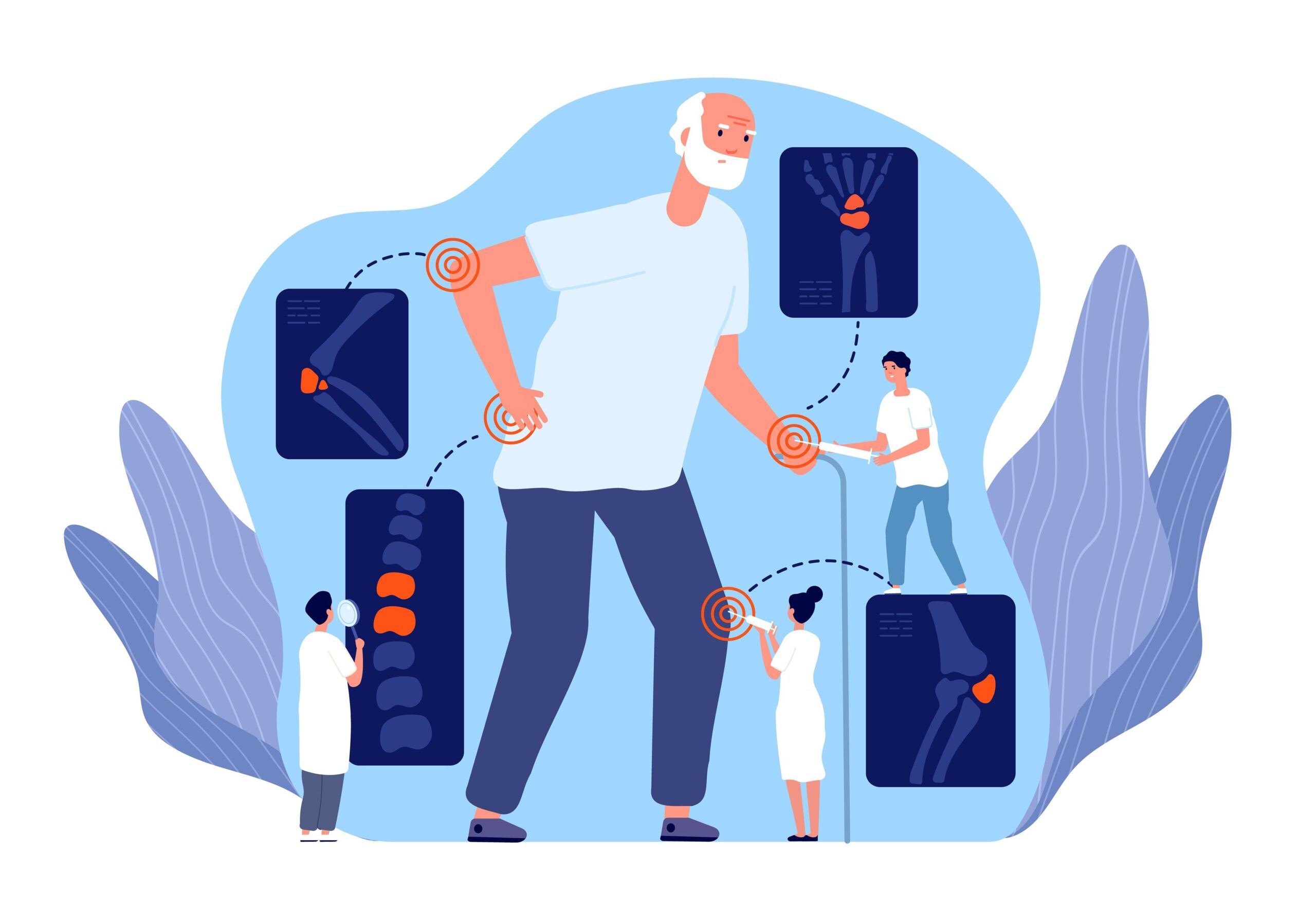 Genetic Study Establishes Causal Link Between RA and Interstitial Lung Disease Risk