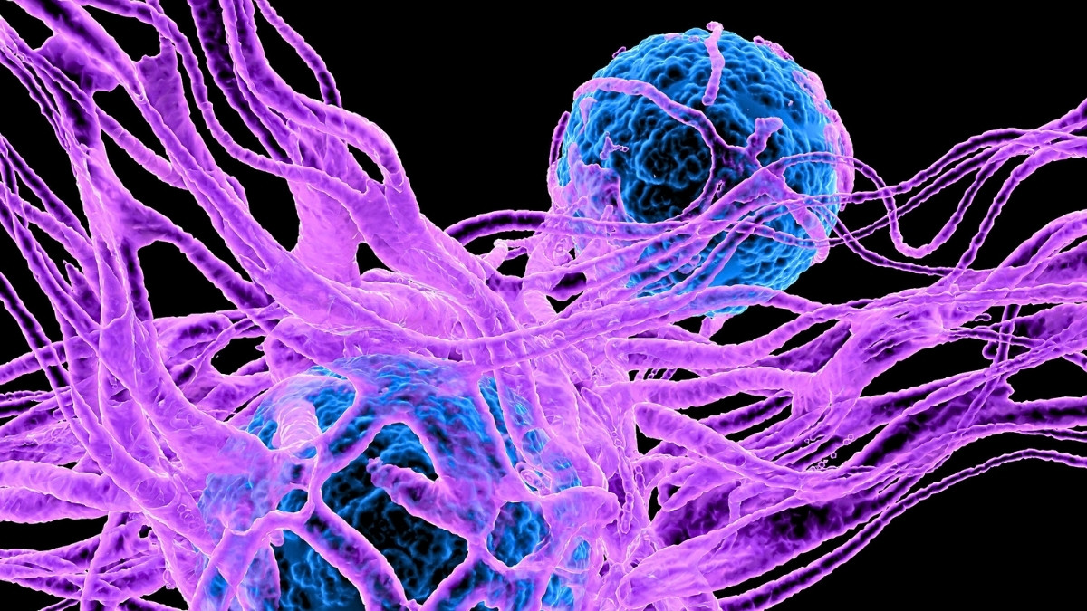 Serotonin Could Play an Unexpected Role in Cancer, Scientists Discover : ScienceAlert