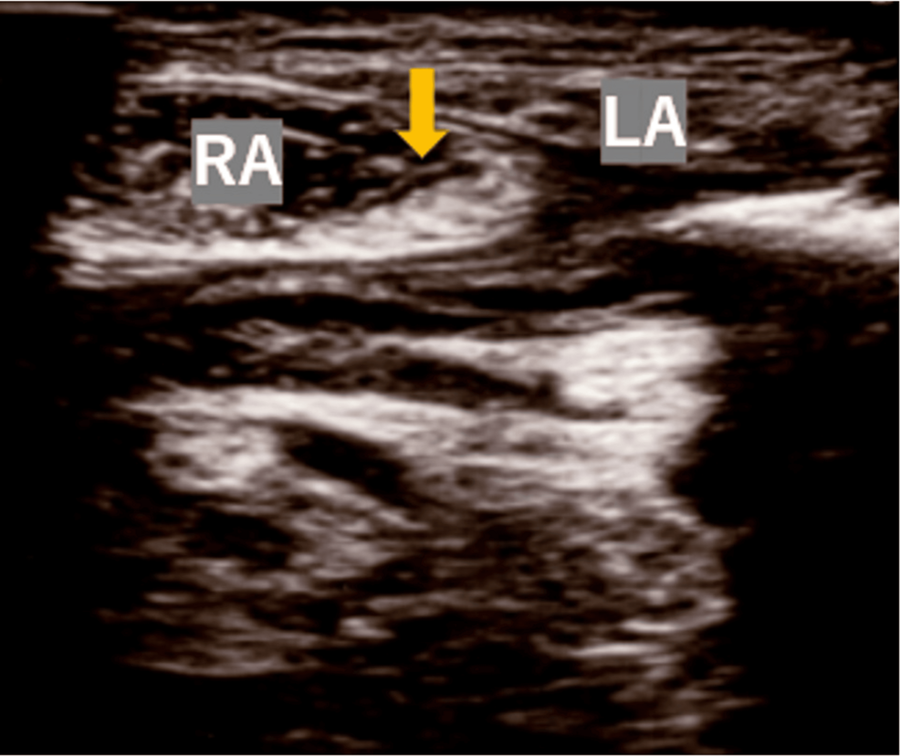 Postoperative Abdominal Myofascial Pain Syndrome in a Cancer Survivor: A Case Report on Diagnostic and Therapeutic Considerations