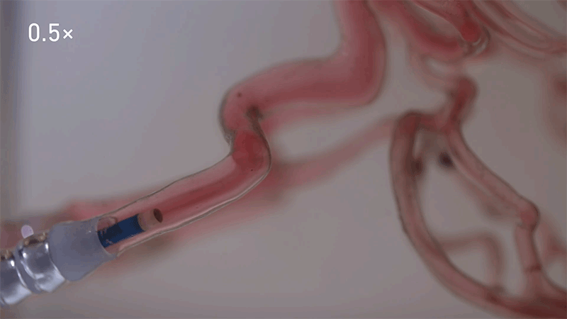 A looping animated sequence showing an insertion catheter with a gripper arm releasing a microrobot into a clear demonstration replica of a human vein.