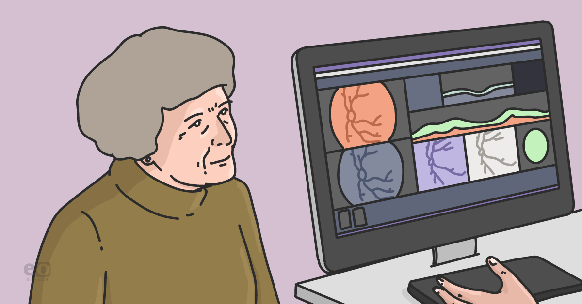 RGC thickness may be early retinal indicator with oral HCQ