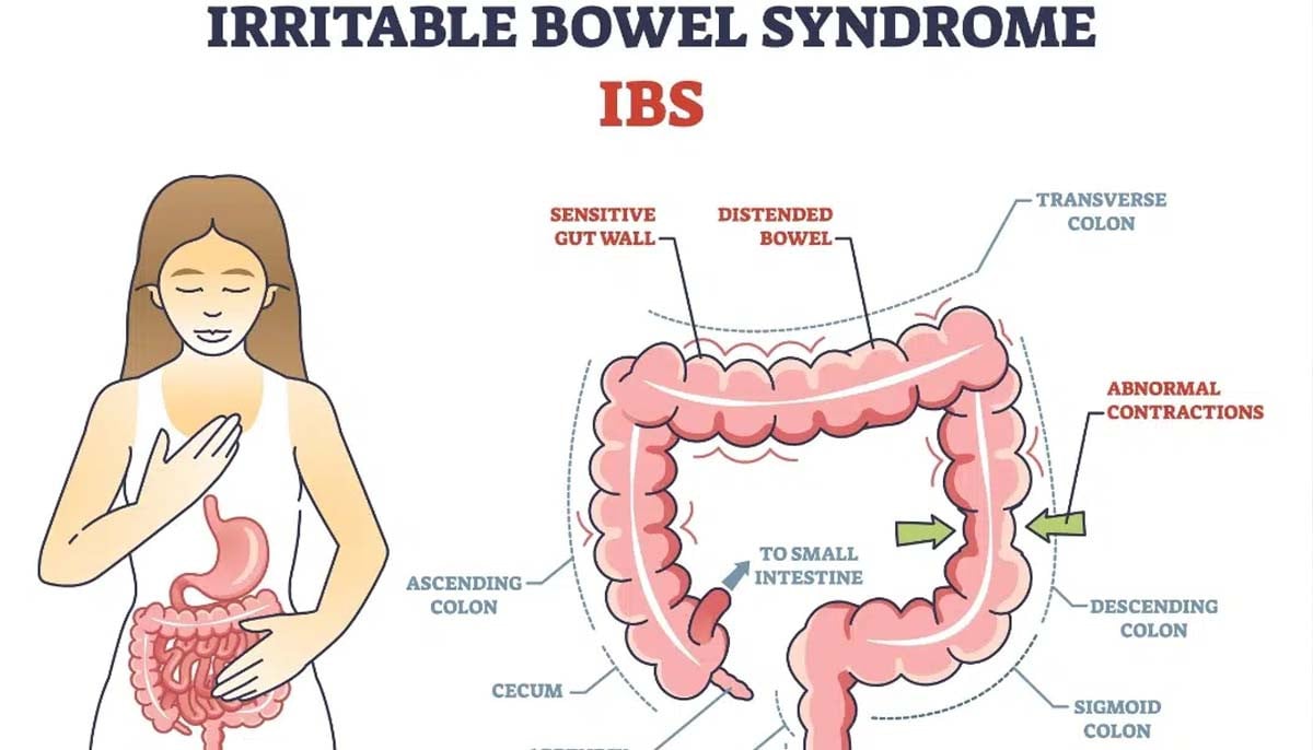 IBS dominance in women reason comes to light