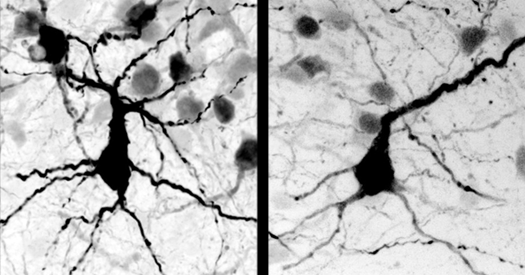 Autism in Kenya, organoid research, and more