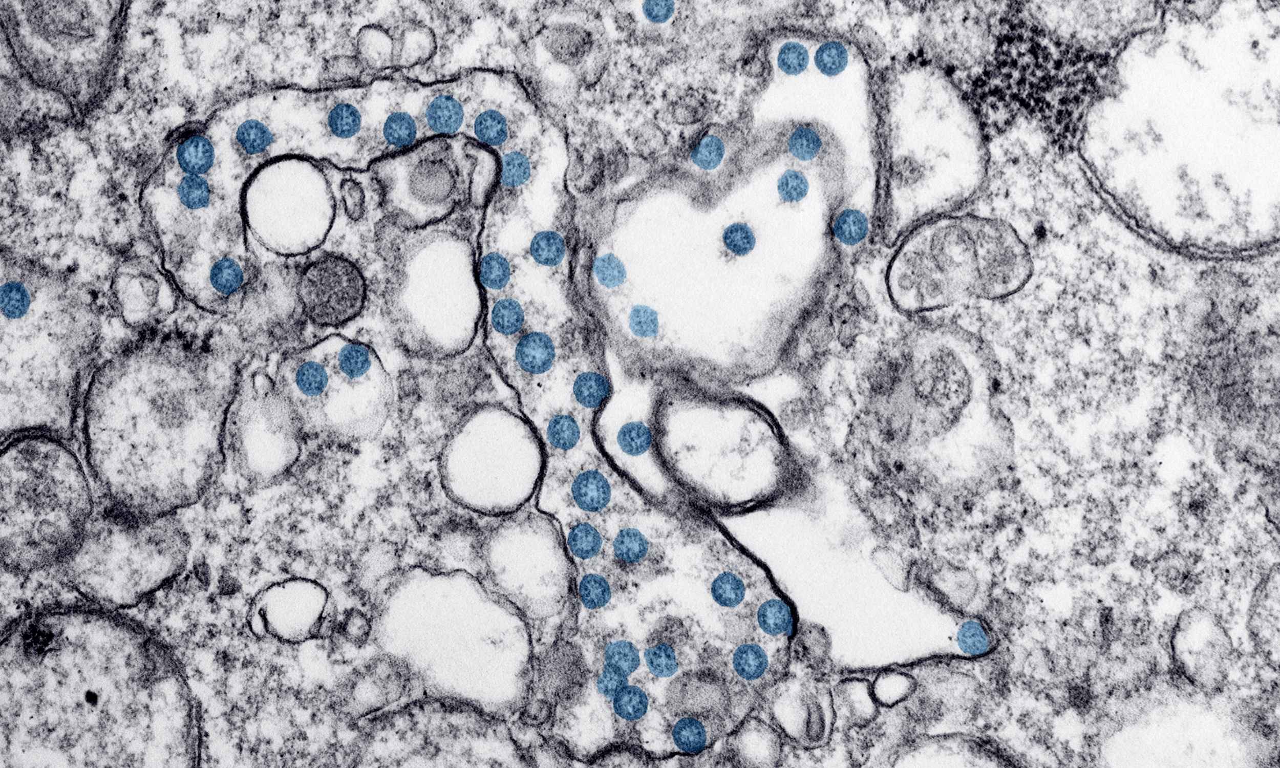 Microbe from 2 billion years ago could be the ancestor of all life