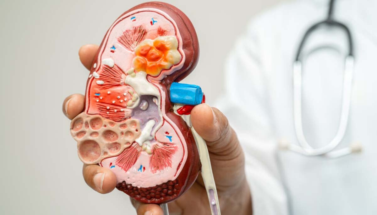 Kidney damage is now reversible: here’s where science stands