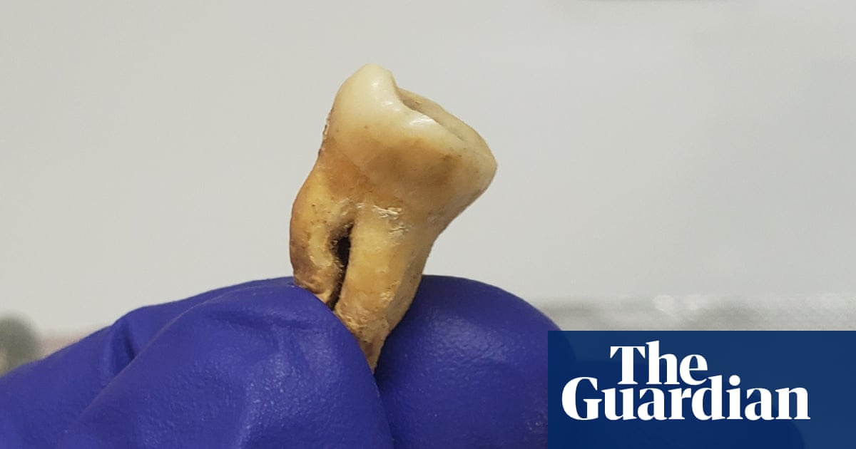 Mass grave in Jordan sheds new light on world’s earliest recorded pandemic | Infectious diseases