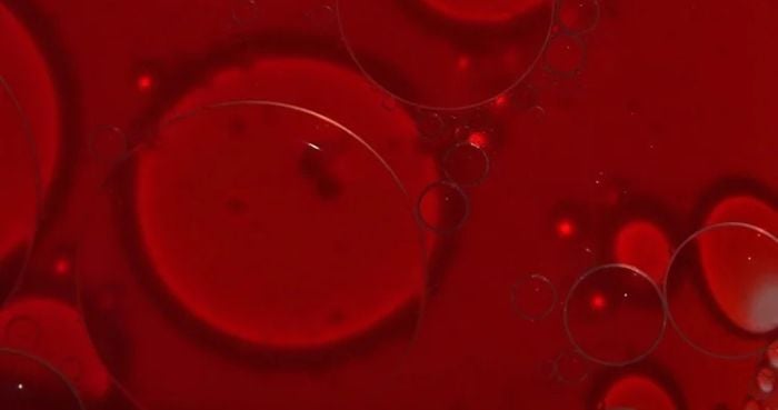 Lower sodium levels linked to higher brain excitability, study finds