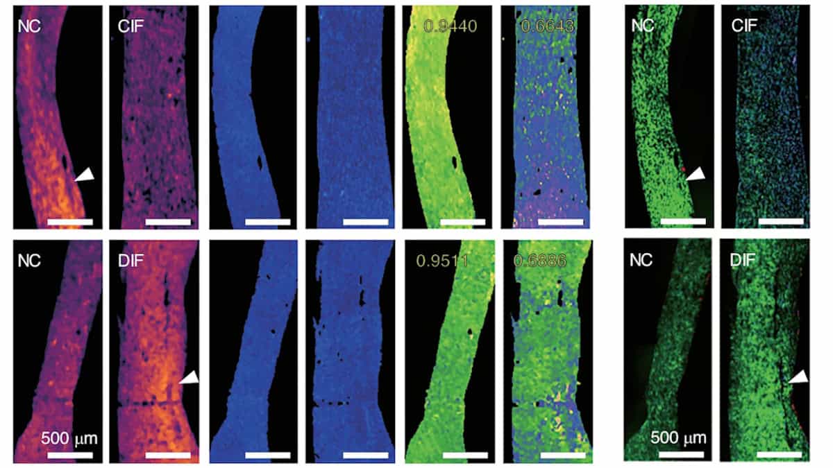 Polarization-sensitive photoacoustic microscopy reveals heart tissue health – Physics World