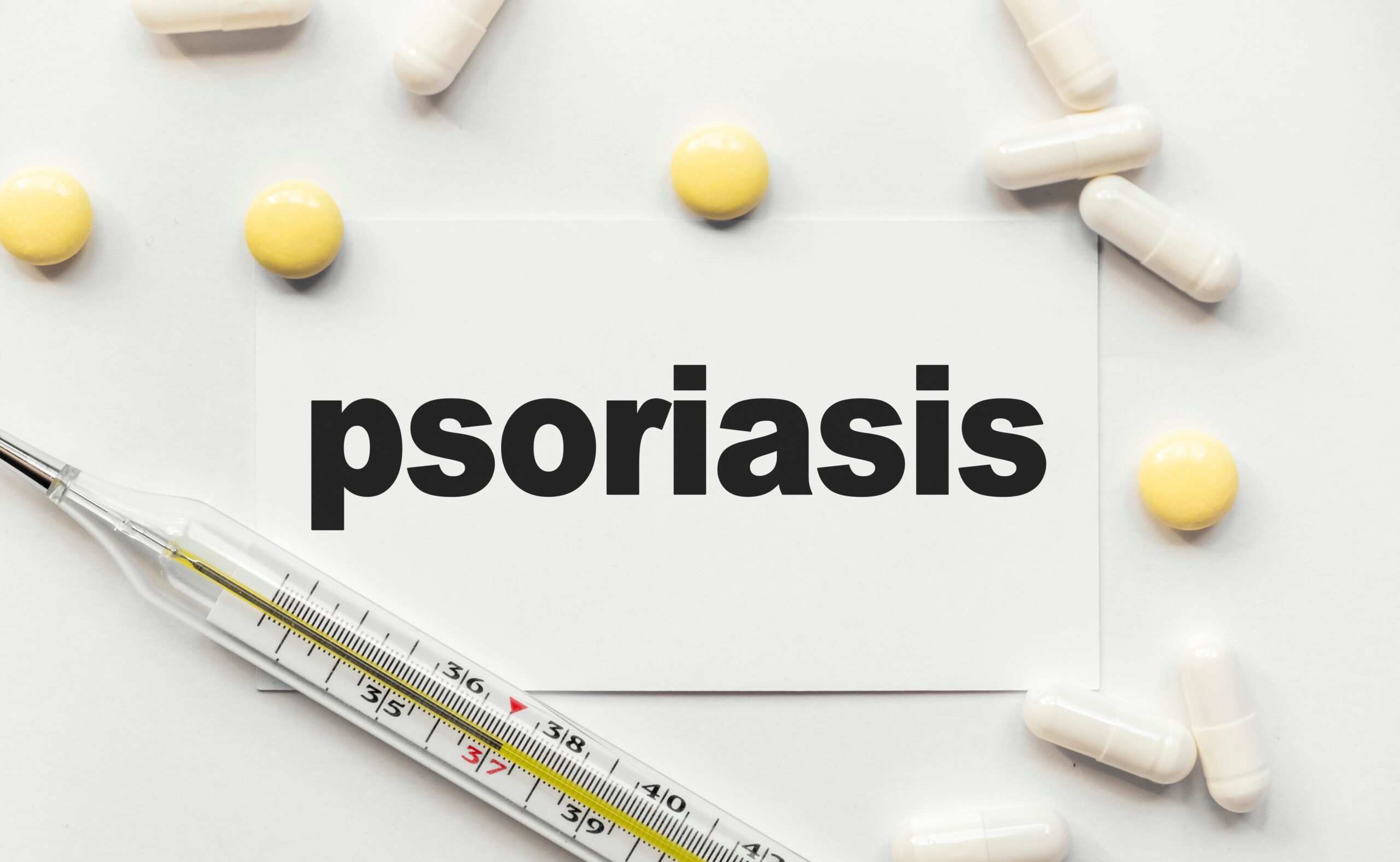 Machine Learning Predicts Hyperglycemia Risk in Psoriasis