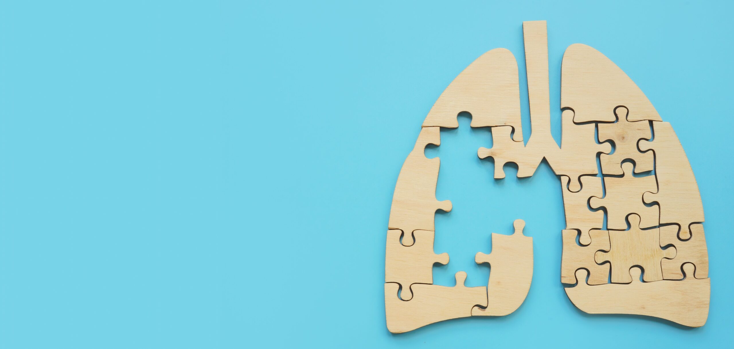 Boehringer Ingelheim Launches Phase 2 Trial of IL-11 Antibody for IPF Treatment