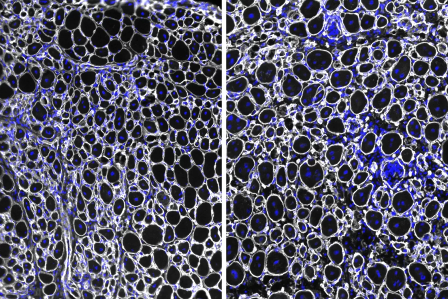 Muscle stem cells become more resistant but less restorative over time