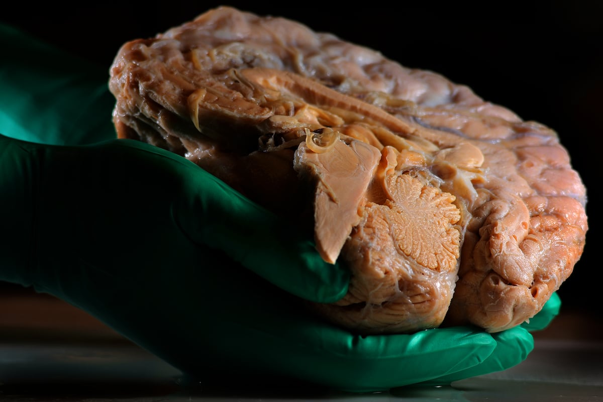 Do you leave everything for later? Japanese scientists have found the reason in the brain | Science