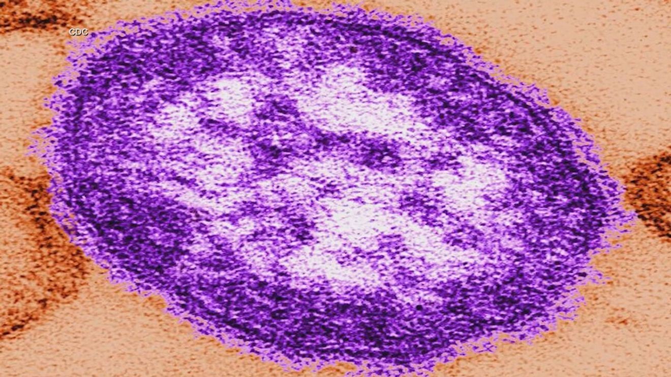 Possible measles exposure reported on Amtrak to DC, BWI shuttles in Maryland