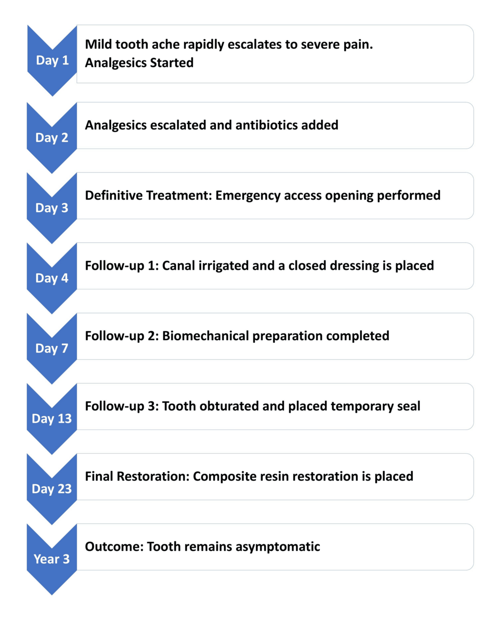 Acute Exacerbation of Chronic Periapical Pathology in a Dentist: An Autobiographical Case Report