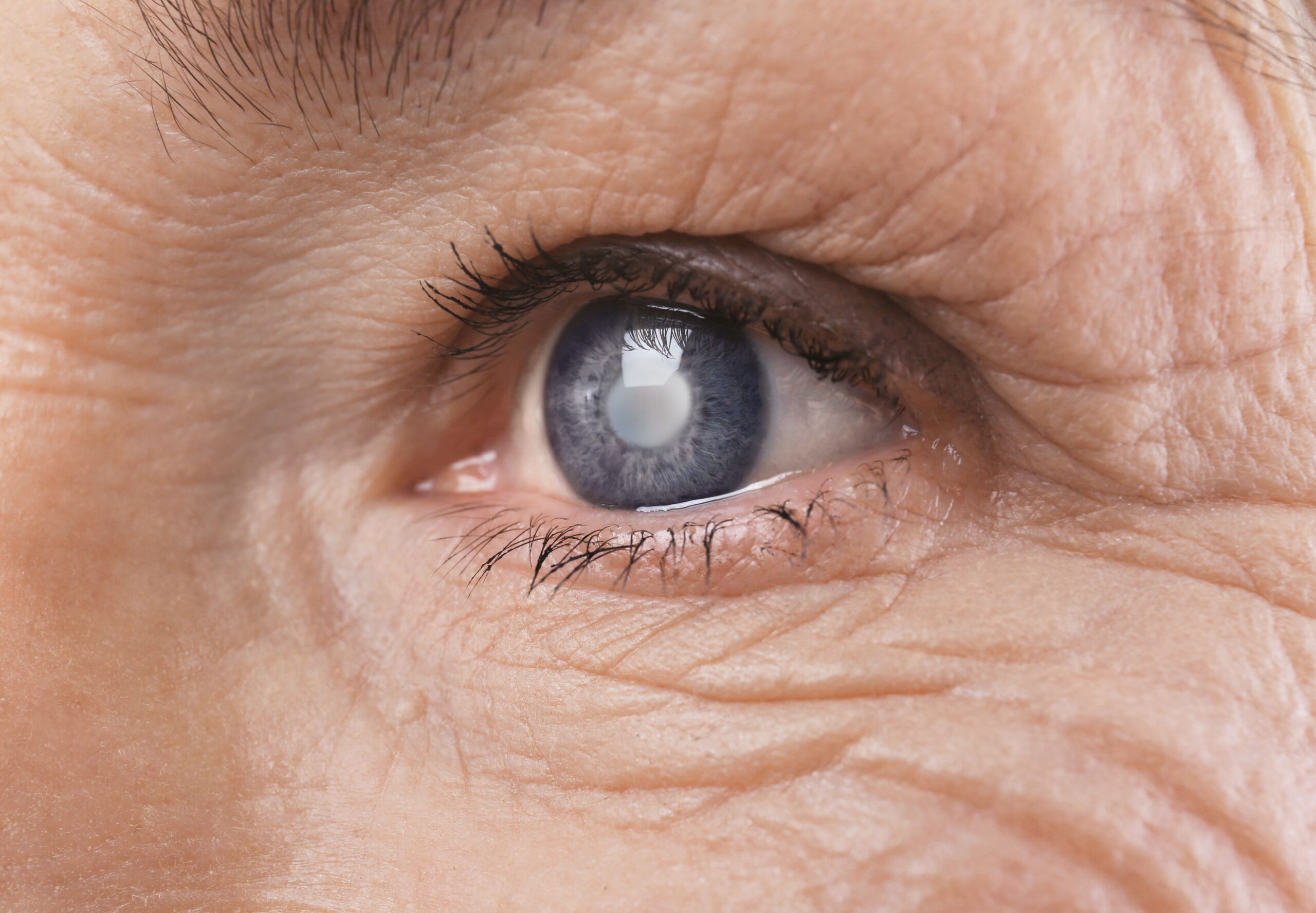 Many inherited eye disease genes rarely cause vision loss, study found
