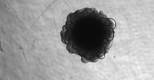 Viral DNA in chimps silences brain gene humans still use