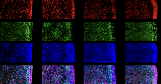 ‘Tour de force’ study flags fount of interneurons in human brain