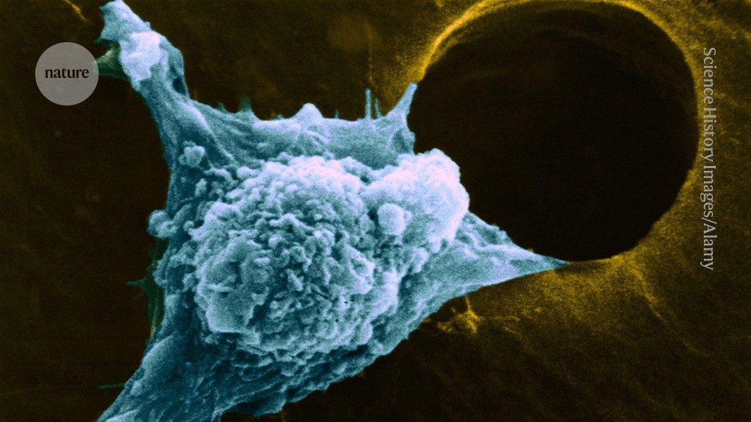 Why cancer can come back years later — and how to stop it