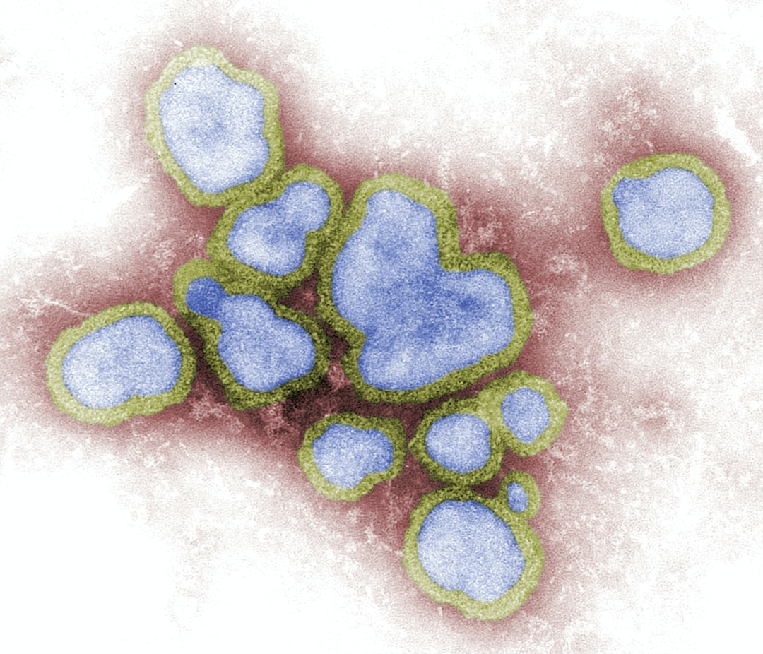 Influenza in the Czech Republic: 49 deaths this season