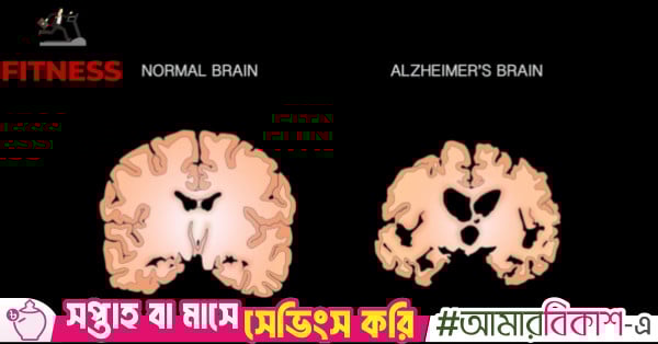 5 longevity hacks to support brain health and lower the risk of Alzheimer’s disease