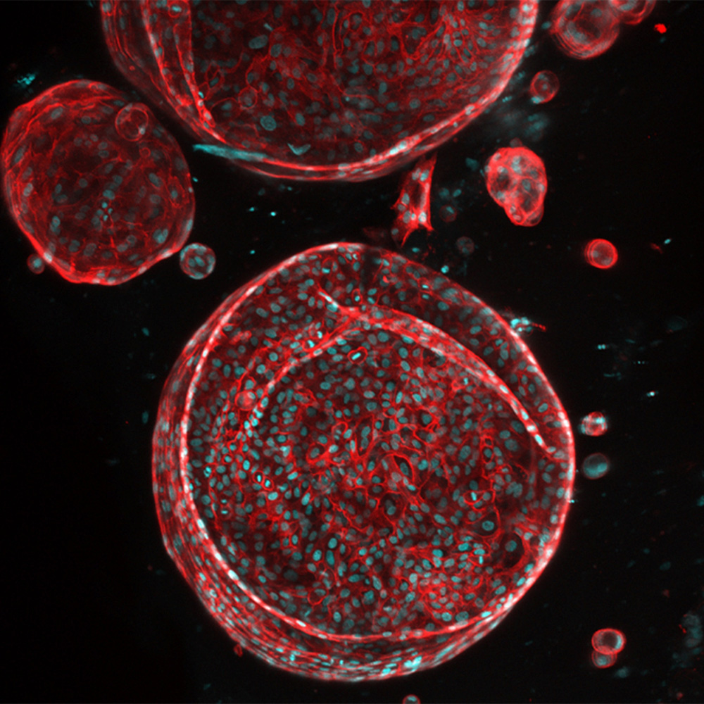 UTSW receives ARPA-H award to create functioning artificial liver: Newsroom