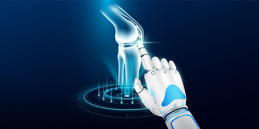 AI-Driven X-Ray Innovation Accelerates Early Arthritis Detection