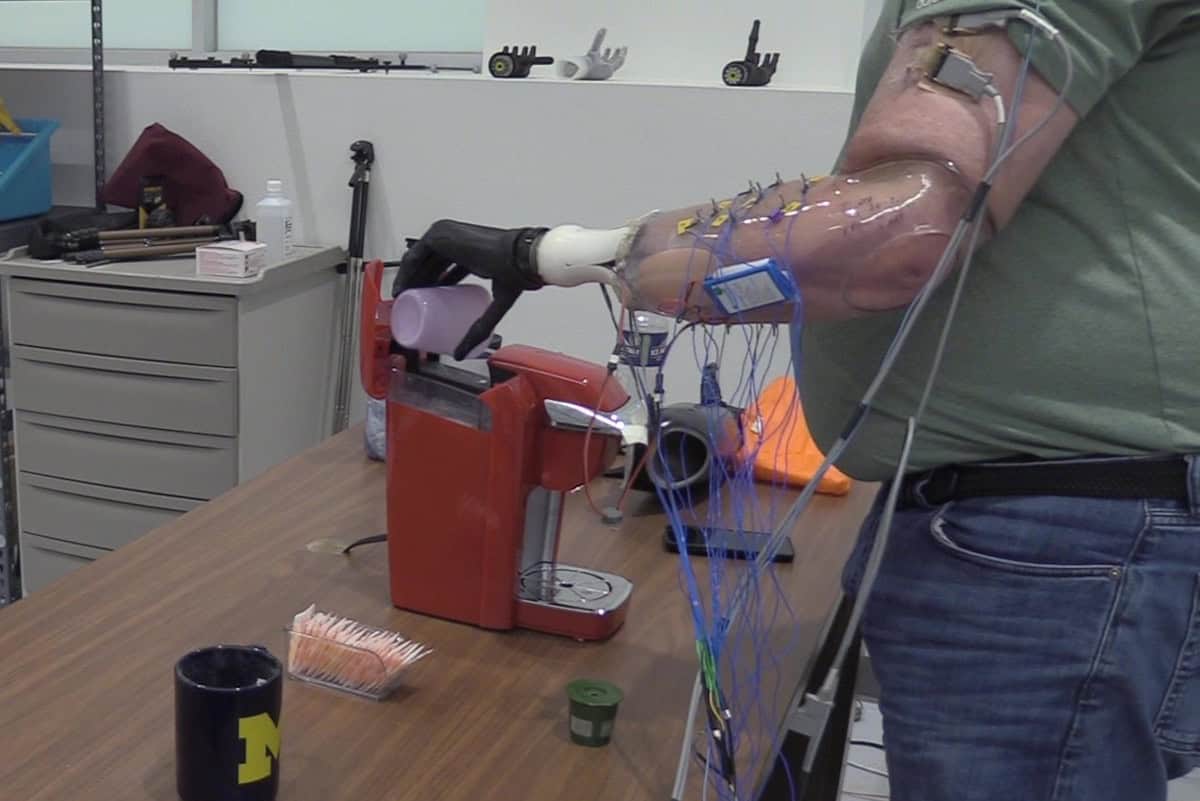 Implanted electrodes provide intuitive control of prosthetic hand – Physics World