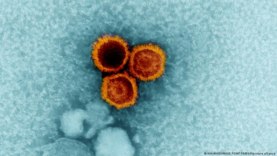 How the Epstein-Barr virus triggers MS in some people