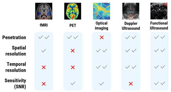 Whole brain network imaging using functional ultrasound