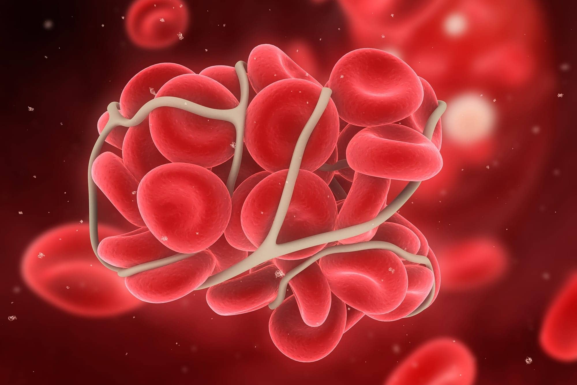 Researchers ID Cause of Blood Clots After COVID Vaccines