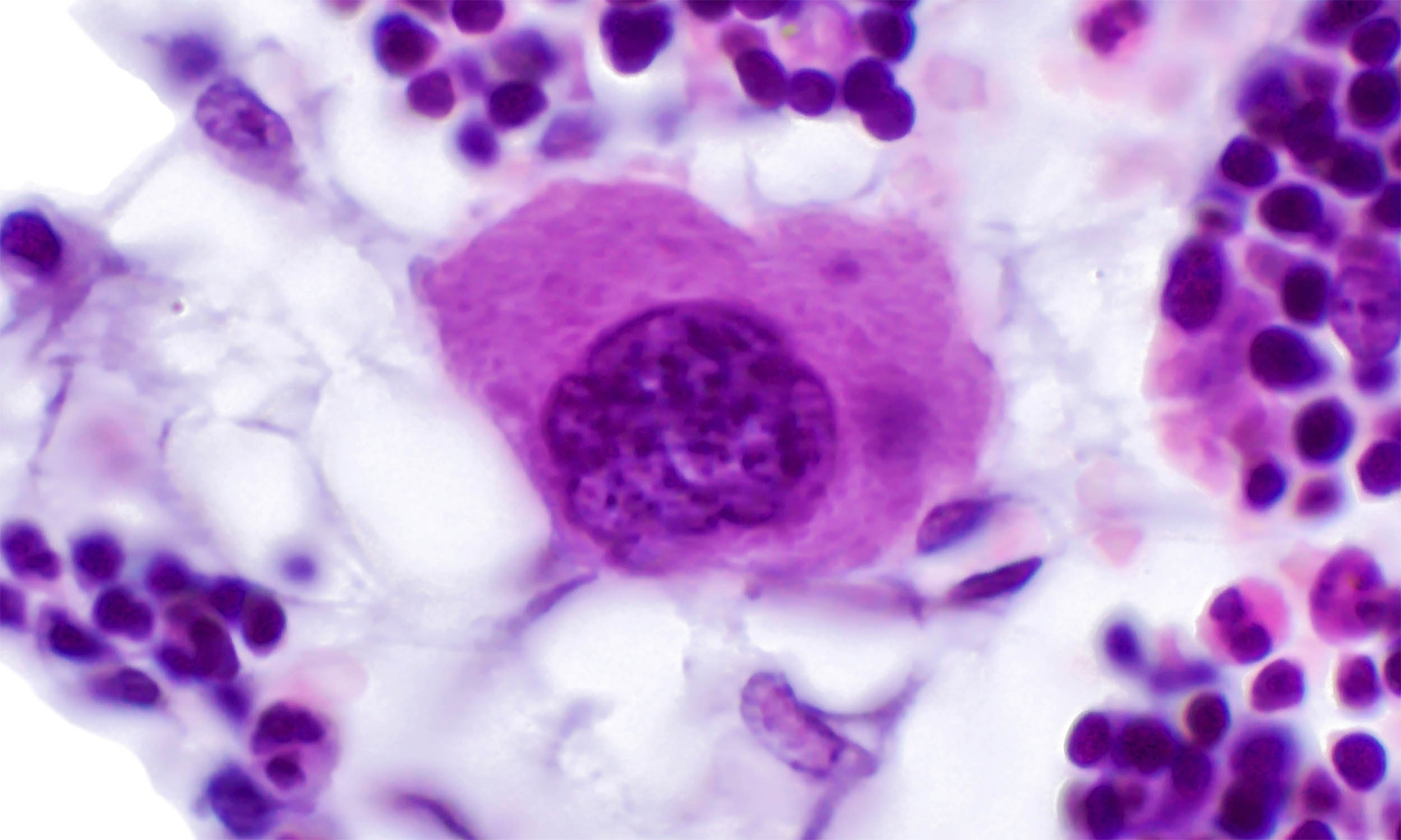 Scientists find the stem cell sensor ‘switch’ that keeps bones strong