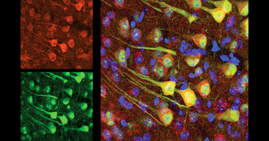 Aging neurons outsource garbage disposal, clog microglia