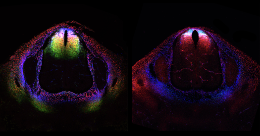 Cell atlas cracks open ‘black box’ of mammalian spinal cord development