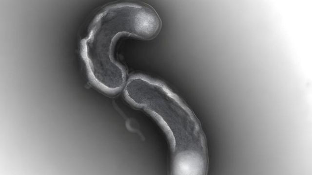 SAR11 Ocean Bacteria Show Hidden Vulnerability To Change