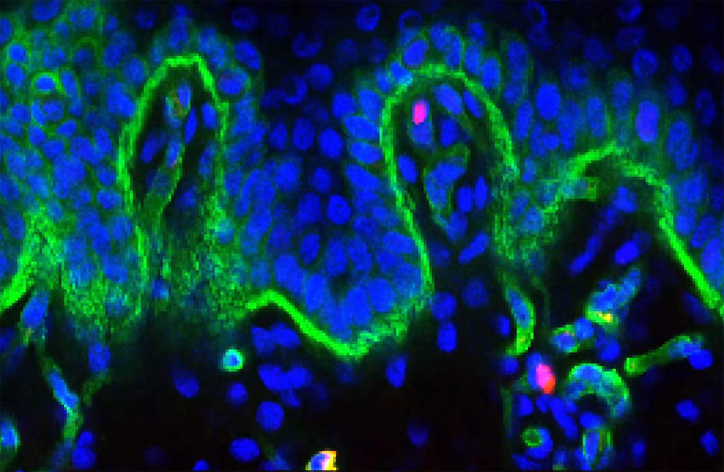 Road map to youthful human skin found in pigs and grizzly bears