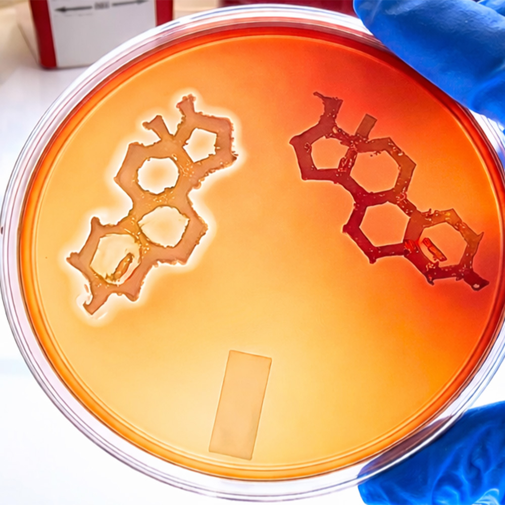 Testosterone increases severity of bacterial skin infections: Newsroom