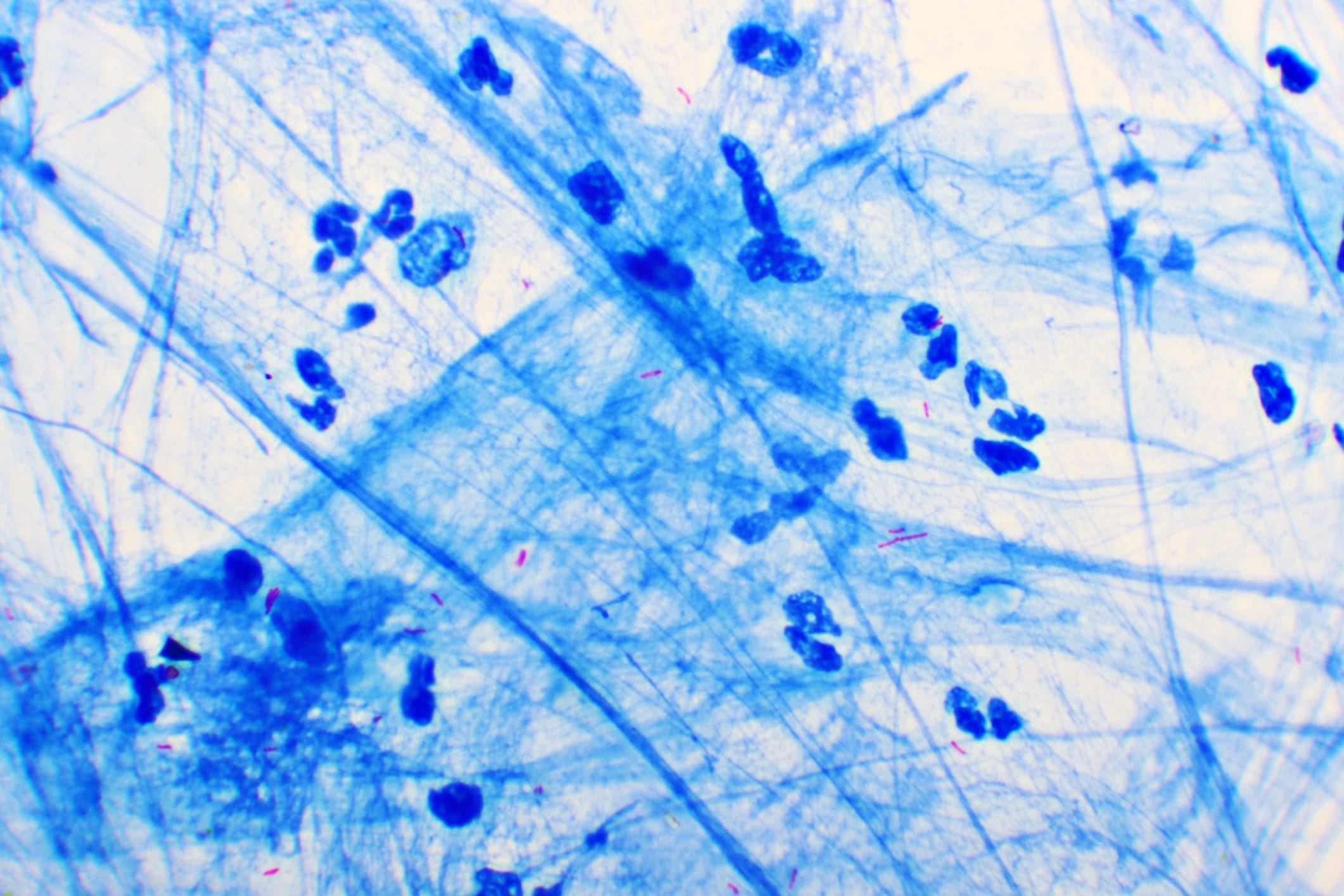 Tuberculosis Mycobacteria Use Stealth to Evade Immune System